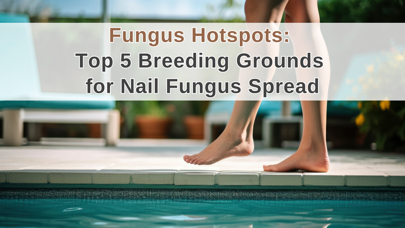 Fungus Hotspots: Top 5 Breeding Grounds for Nail Fungus Spread