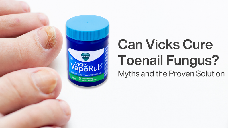 Can Vicks Cure Toenail Fungus? Myths and the Proven Solution