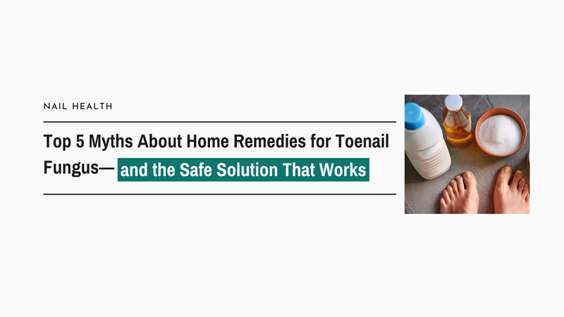 Top 5 Myths About Home Remedies for Toenail Fungus—and the Safe Solution That Works