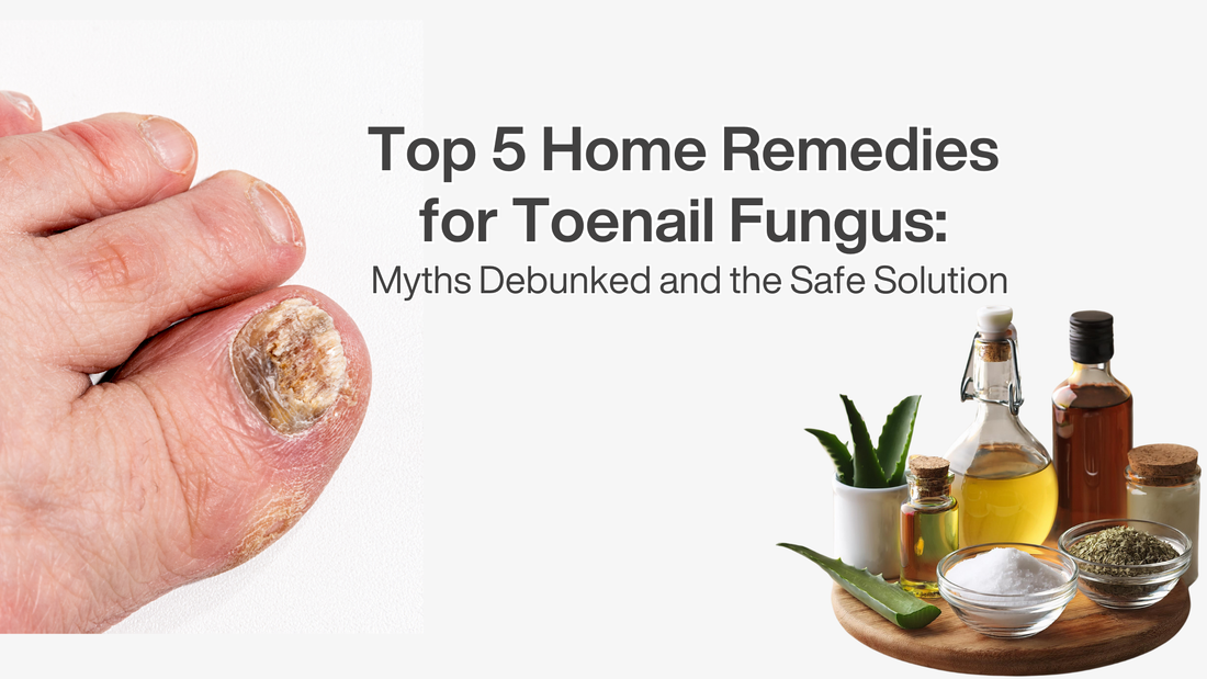 Top 5 Home Remedies for Toenail Fungus: Myths Debunked and the Safe Solution