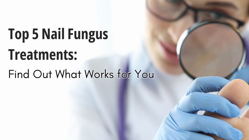 Top 5 Nail Fungus Treatments: Find Out What Works for You