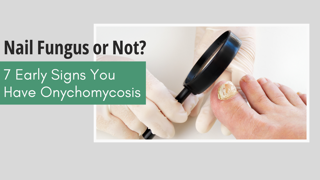 Nail Fungus or Not? 7 Early Signs You Have Onychomycosis