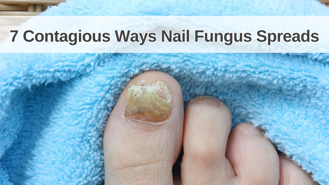 7 Contagious Ways Nail Fungus Spreads