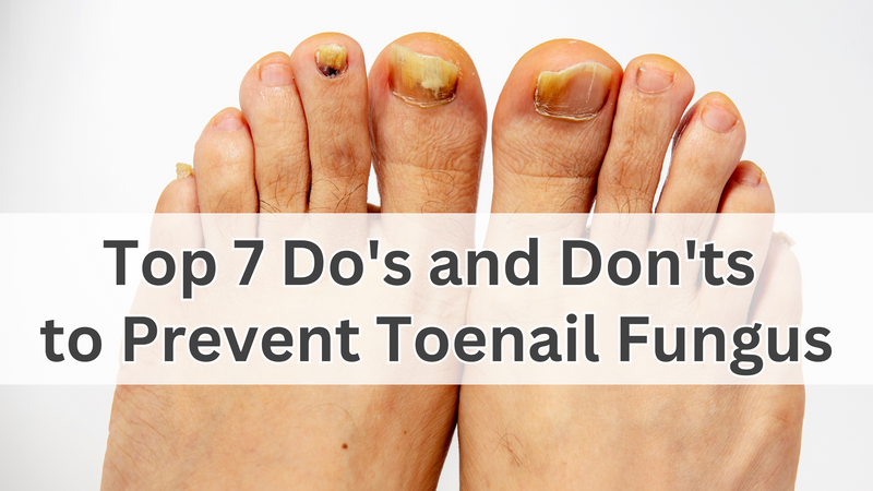 Top 7 Do's and Don'ts to Prevent Toenail Fungus